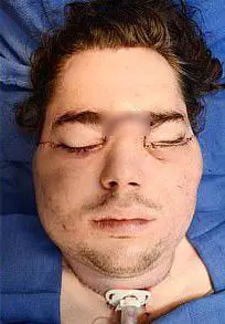 肥宅哥受夠單身「拿命運左輪」爆臉 找捐贈者換臉後...人生大起飛變超模等級!