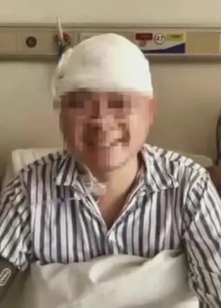 開頭顱手術做到一半 病患被喚醒唱歌