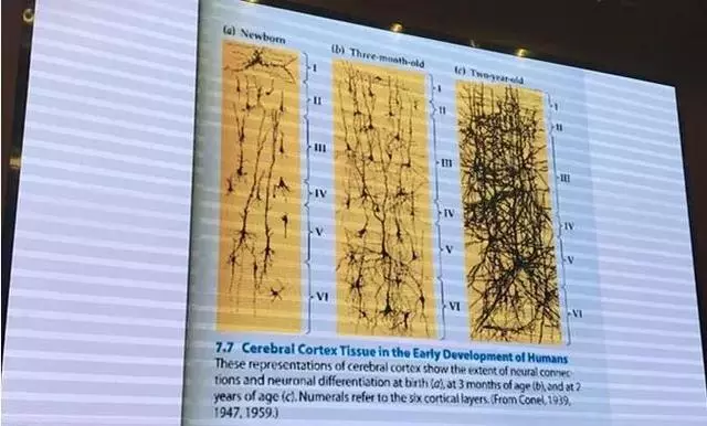 洪蘭教授:開發孩子大腦最高效的三個方式:運動、閱讀和遊戲!