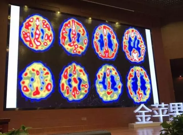 洪蘭教授:開發孩子大腦最高效的三個方式:運動、閱讀和遊戲!