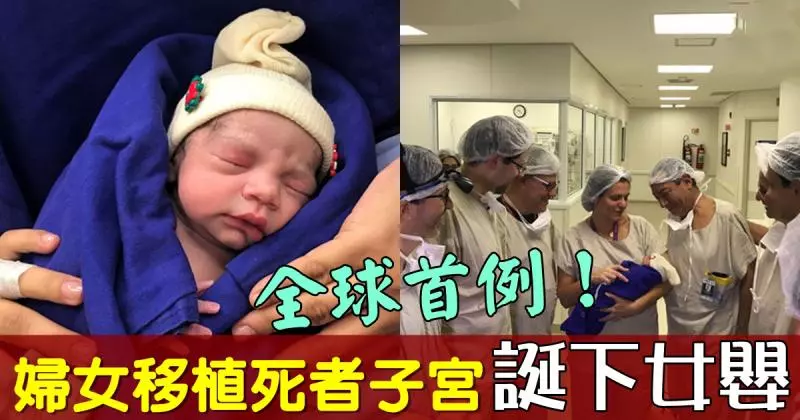 婦女「移植死者子宮」,成功誕下女嬰!