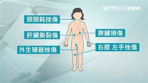 1歲女童肝臟破裂亡 遭母同居人狂踹