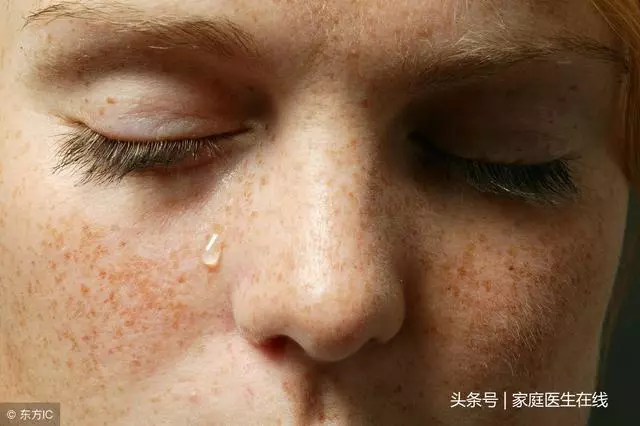 為什麼臉上越來越多黃褐斑?與3個因素有關,第一個最無奈