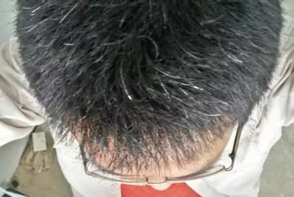 人未老頭髮就白了?原來是你的身體缺少某些營養素!「這麼做」讓白髮變回黑髮哦!!!
