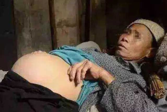 六旬老人意外懷孕,兒女勸其打掉,老人掀開衣服,讓家人跪地哭泣!