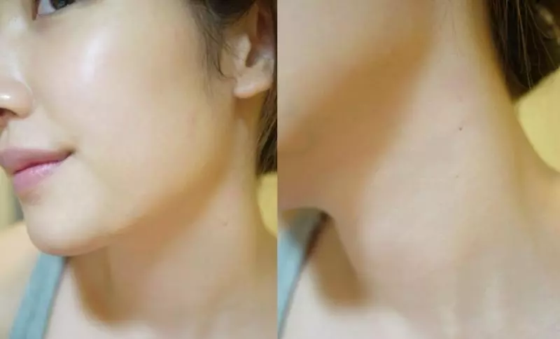 【告別眼周和脖子上的惱人脂肪粒!只花了1個月姊妹倆的皮膚都變得超光滑!