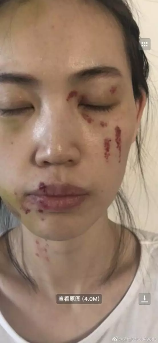 馬蓉爆頭破相照 友誓要王寶強吃牢飯