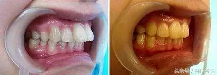 注意!身體這一出「發癢」,可能血糖高了!出現這10種癥狀,是「糖尿病」的早期信號!你最好檢查一下!
