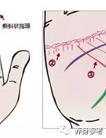 幾乎失傳的「手診」口訣,終於找全了!現在還不看,就虧大了!