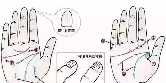 幾乎失傳的「手診」口訣,終於找全了!現在還不看,就虧大了!