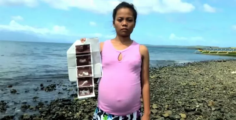 真的懷了魚寶寶嗎?菲律賓少女疑跟海中異形「亂來」致肚子變大,超音波發現「魚寶寶」!
