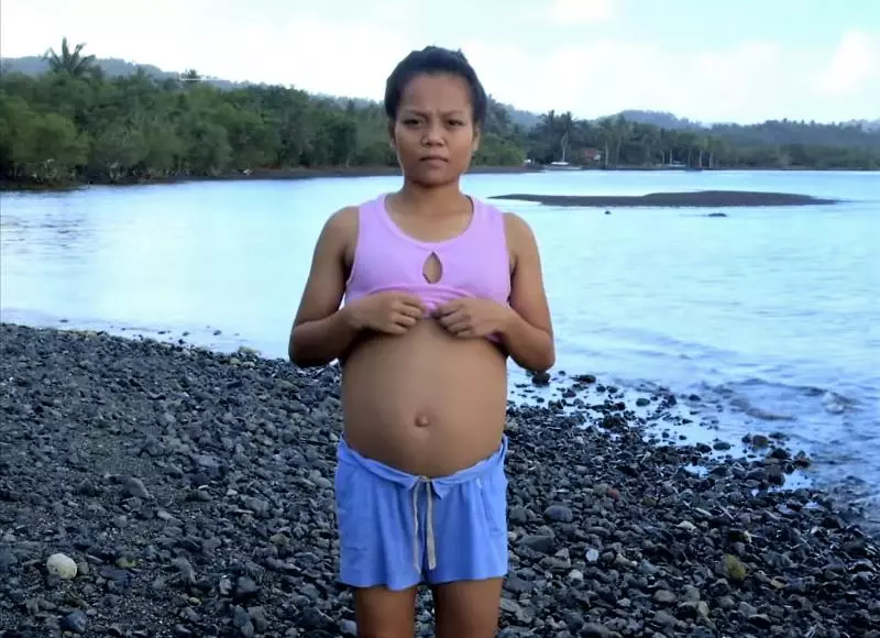 真的懷了魚寶寶嗎?菲律賓少女疑跟海中異形「亂來」致肚子變大,超音波發現「魚寶寶」!