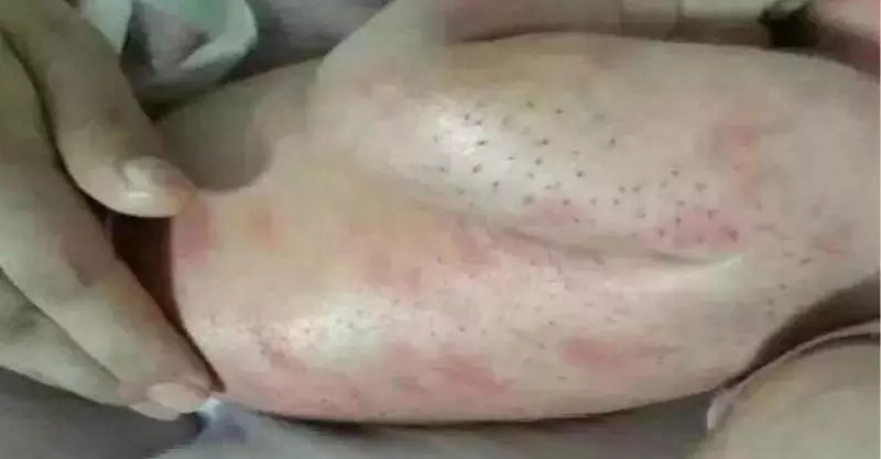 女子發現女兒身上有「刺」,女子將其全部拔掉,結果女兒去世 !