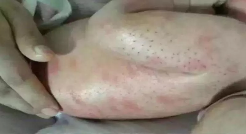 女子發現女兒身上有「刺」,女子將其全部拔掉,結果女兒去世 !