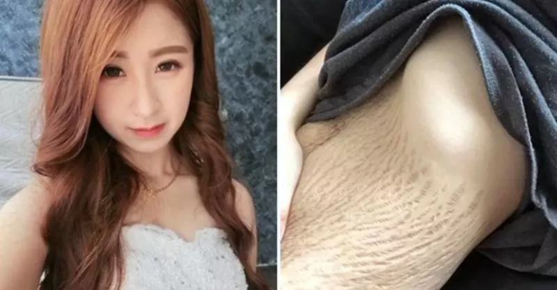 21歲辣媽生四胞胎「驚見肚皮裂開」被酸很噁心!她PO比基尼照怒轟:「尊重全世界的女性!」