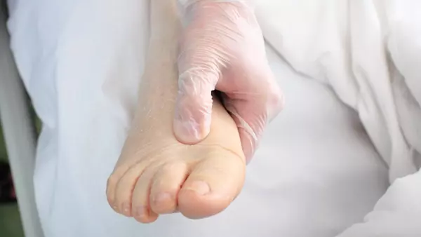 你「腫」了嗎?這6種水腫小心疾病已經找上你!