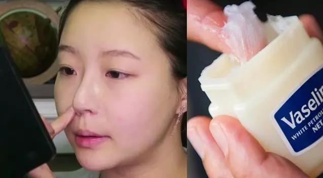 她用「凡士林敷鼻頭」粉刺全爆出!一轉眼浮出「滿滿粉刺林」,超高CP完勝K牌白泥面膜!