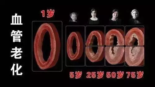 這根血管連通大腦最容易堵!很多人半身不遂之後才發現!慶幸的是,你現在看到這篇文章