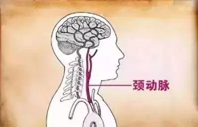 這根血管連通大腦最容易堵!很多人半身不遂之後才發現!慶幸的是,你現在看到這篇文章