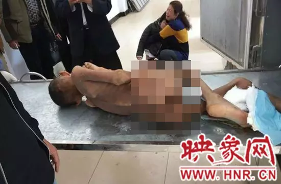 河南信陽一男童走失半年,被發現後已瘦成乾屍 !