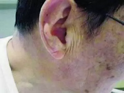 失傳已久的偏方,能將血管洗到乾乾淨淨!效果非常好! 一次轉發,救人無數!!
