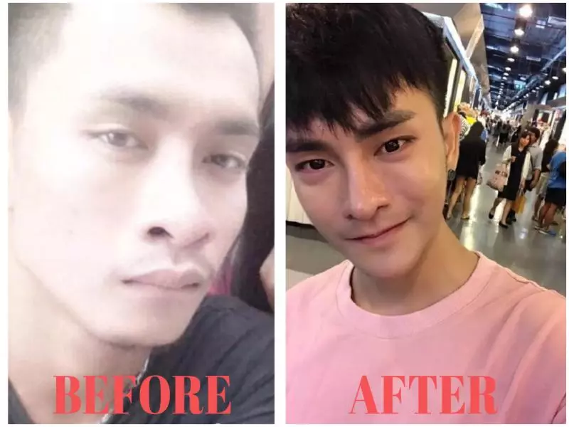顏值會影響找工作嗎? 泰男整成珉豪後拿到夢想工作