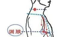 膽經大藥房——從上至下,按摩這些穴位消除疾病,立竿見影
