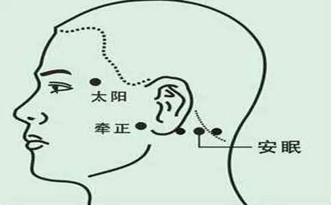每天學一點中醫:3個穴位祛失眠,頭痛!耳聾耳鳴,一拍就靈!