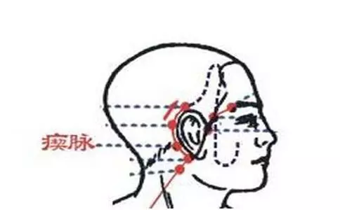 每天學一點中醫:3個穴位祛失眠,頭痛!耳聾耳鳴,一拍就靈!
