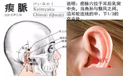每天學一點中醫:3個穴位祛失眠,頭痛!耳聾耳鳴,一拍就靈!
