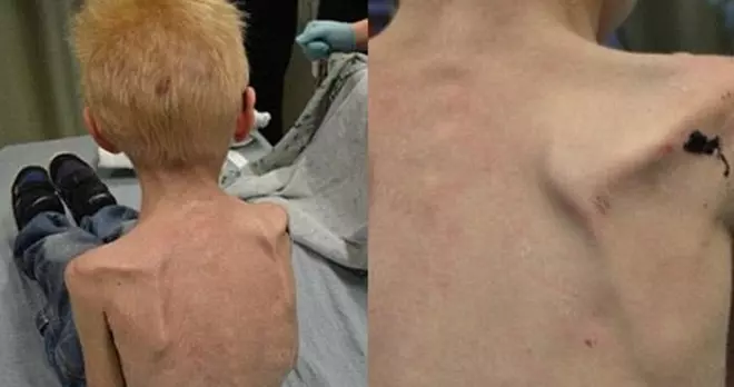 5歲男童遭繼母虐待 每天只准喝一杯水一片麵包 5歲男童遭繼母虐待 每天只准喝一杯水一片麵包
