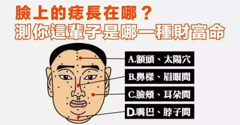臉上的痣長在哪?測你這輩子是哪一種財富命!