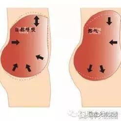 每天這樣做「甩手操」,甩掉一身疾病讓你「通體舒暢」!