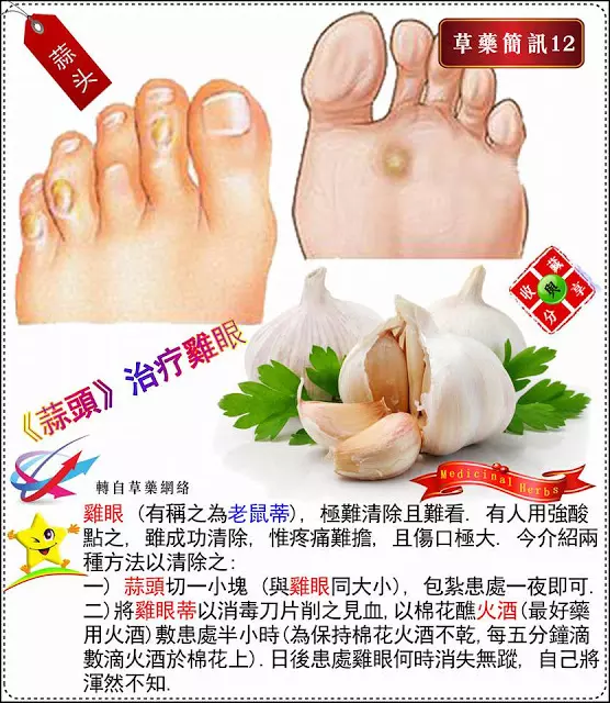 30種草藥簡訊!!必要收藏起來!!!