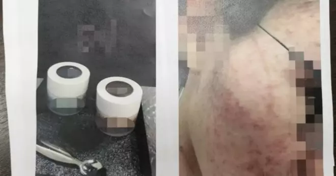 護膚品停用後產生副作用 料500人遭殃!