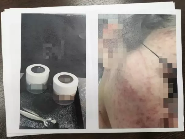 護膚品停用後產生副作用 料500人遭殃!