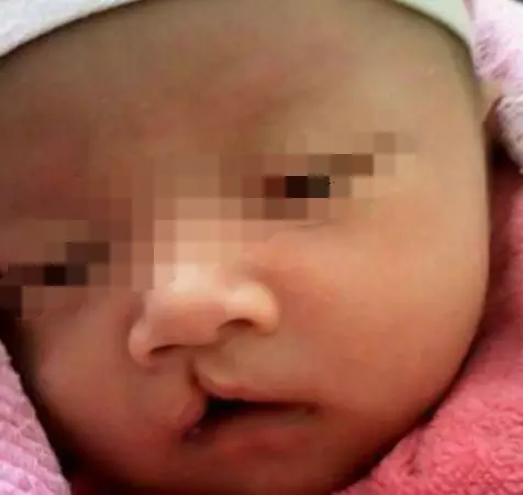 25歲女子連生三胎都是兔唇,醫生查出真相,女子怒打婆婆!