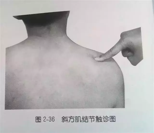 肩部疼痛圖解(很珍貴)