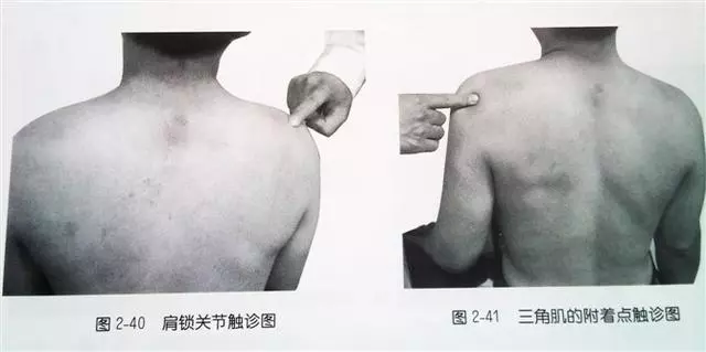 肩部疼痛圖解(很珍貴)