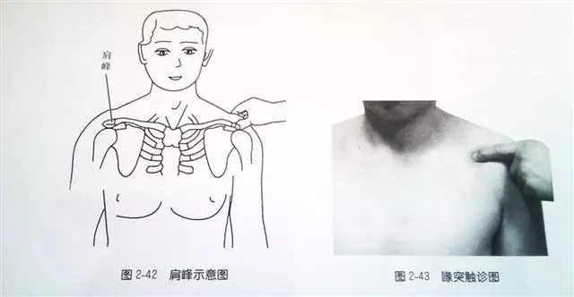肩部疼痛圖解(很珍貴)