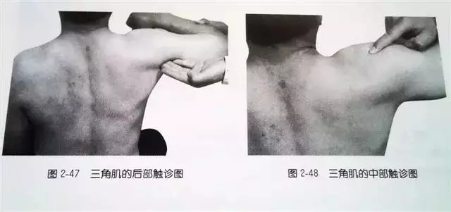 肩部疼痛圖解(很珍貴)