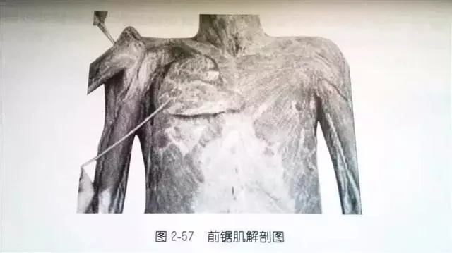 肩部疼痛圖解(很珍貴)
