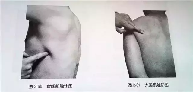 肩部疼痛圖解(很珍貴)