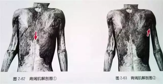 肩部疼痛圖解(很珍貴)