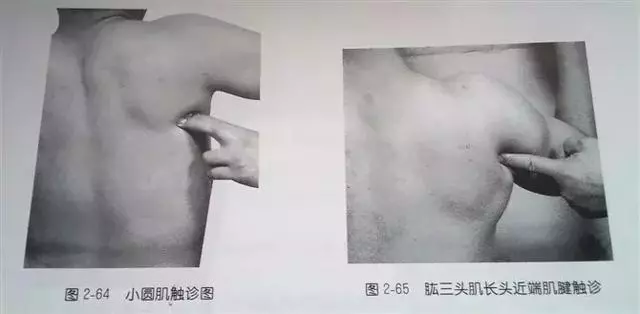 肩部疼痛圖解(很珍貴)