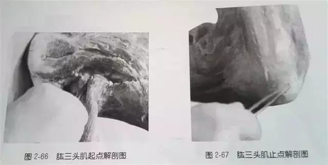 肩部疼痛圖解(很珍貴)