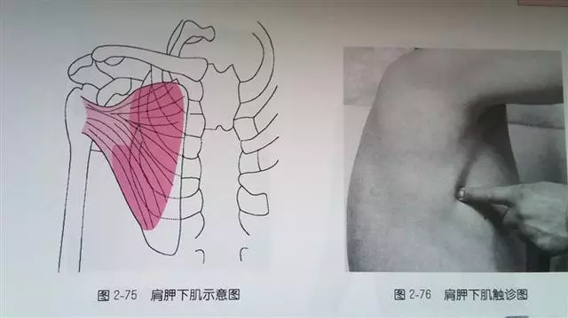 肩部疼痛圖解(很珍貴)