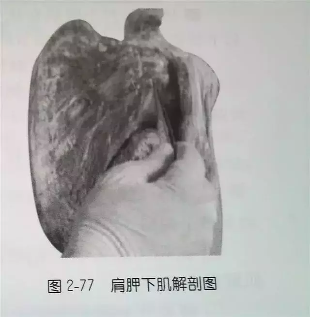 肩部疼痛圖解(很珍貴)