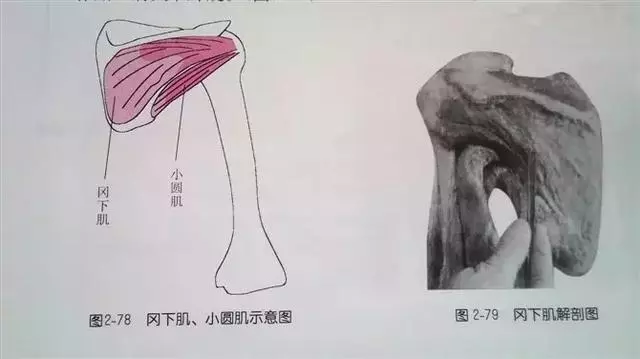 肩部疼痛圖解(很珍貴)