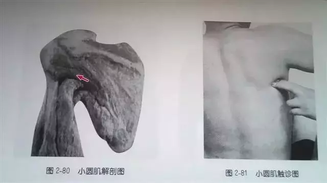 肩部疼痛圖解(很珍貴)